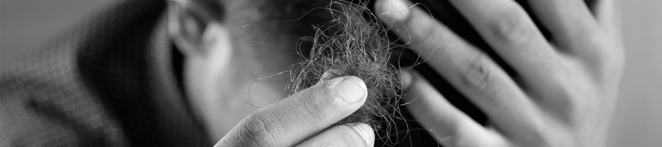 mężczyzna trzyma w palcach kępkę włosów