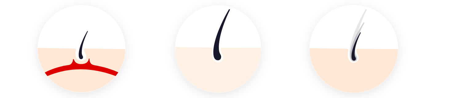 fazy wzrostu mieszka włosowego