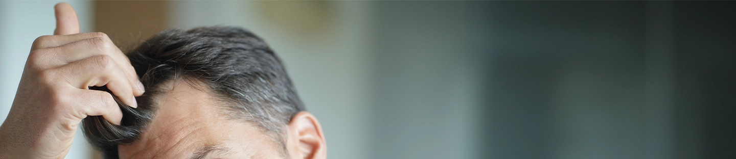 mężczyzna sprawdza stan swoich włosów na głowie